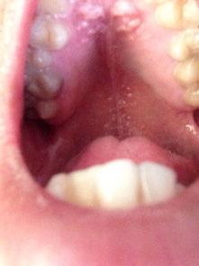 吃白瓜喉咙痒,揭秘原因及应对策略