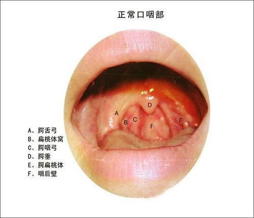 吃白瓜喉咙痒,揭秘原因及应对策略